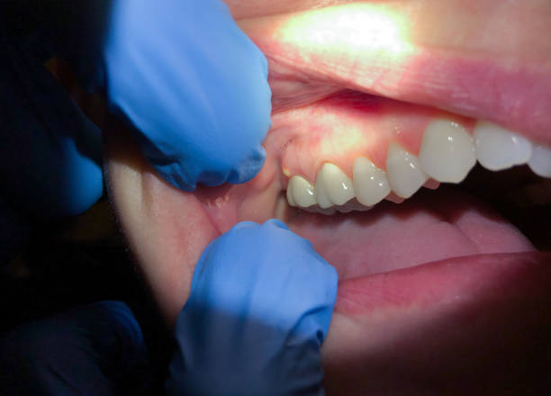 Reliable MS Emergency Dentist Solutions
