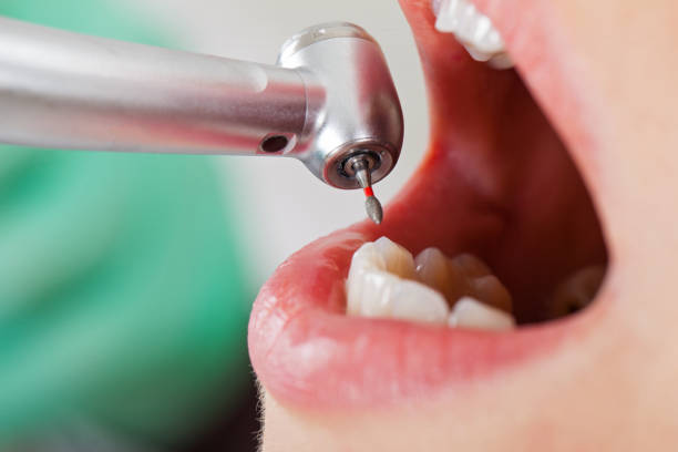 Best Same-Day Emergency Dentist in Stonewall, MS
